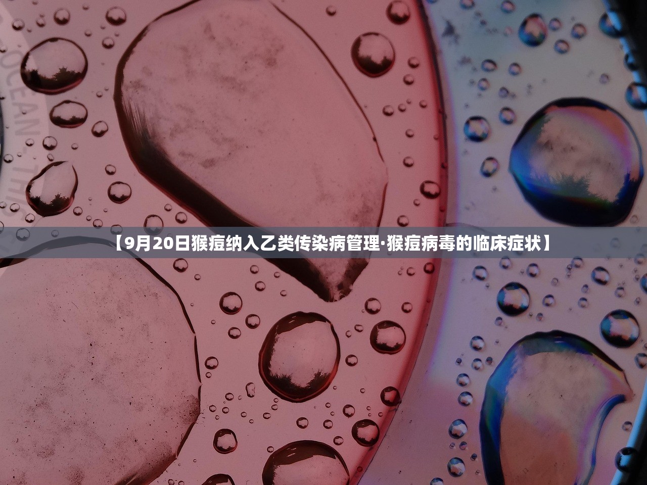【9月20日猴痘纳入乙类传染病管理·猴痘病毒的临床症状】