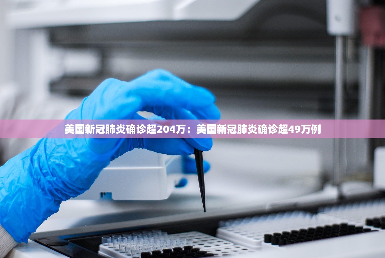 美国新冠肺炎确诊超204万:美国新冠肺炎确诊超49万例 美国新冠肺炎确诊超204万:美国新冠肺炎确诊超49万例