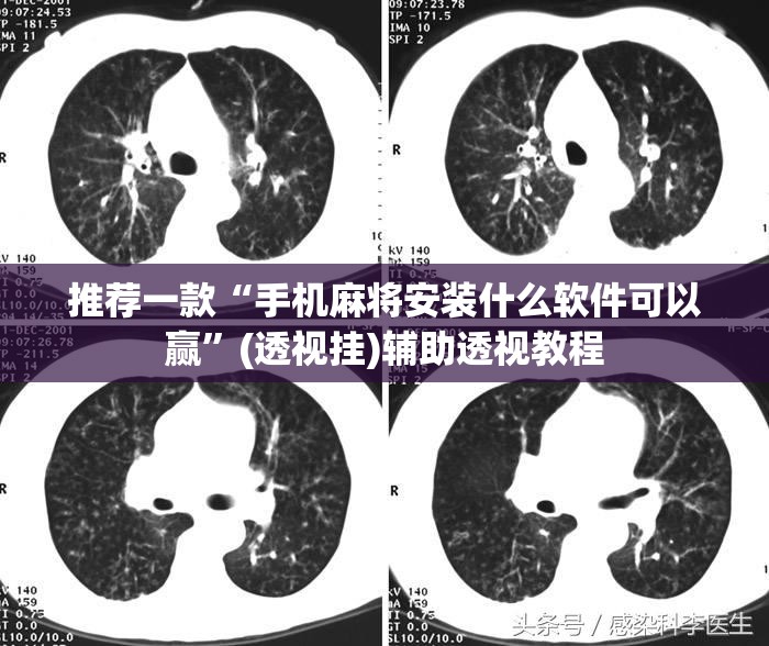 推荐一款“手机麻将安装什么软件可以赢	”(透视挂)辅助透视教程