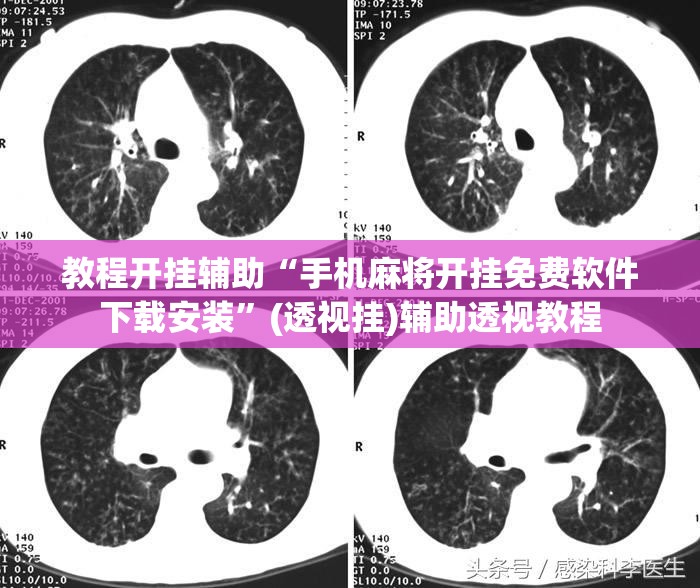 教程开挂辅助“手机麻将开挂免费软件下载安装”(透视挂)辅助透视教程