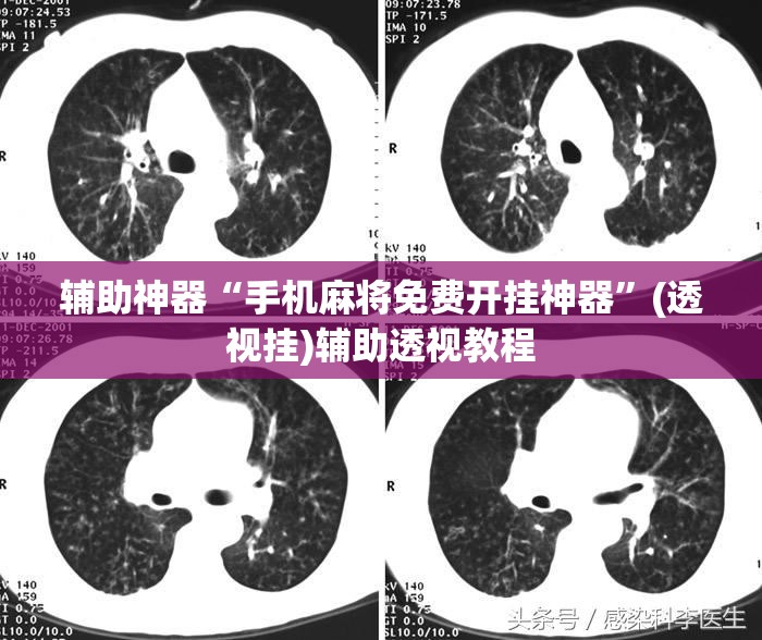辅助神器“手机麻将免费开挂神器	”(透视挂)辅助透视教程