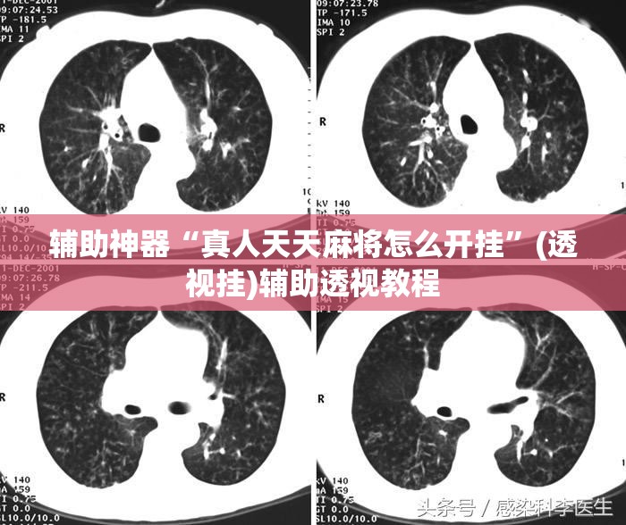 辅助神器“真人天天麻将怎么开挂	”(透视挂)辅助透视教程