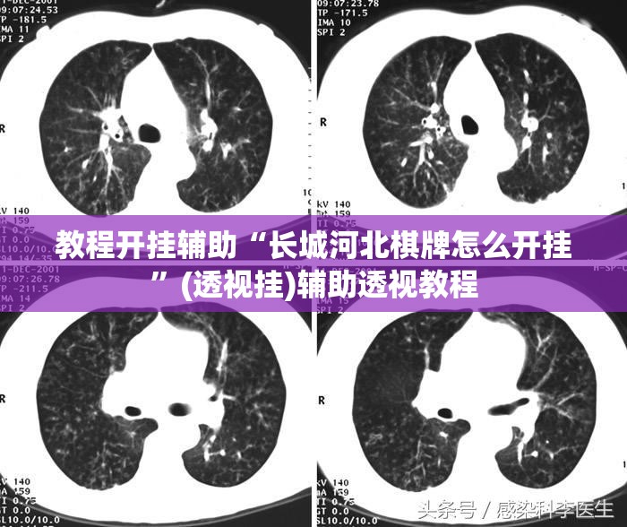 教程开挂辅助“长城河北棋牌怎么开挂”(透视挂)辅助透视教程
