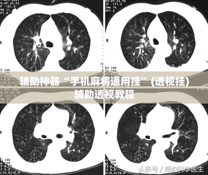 辅助神器“手机麻将通用挂”(透视挂)辅助透视教程