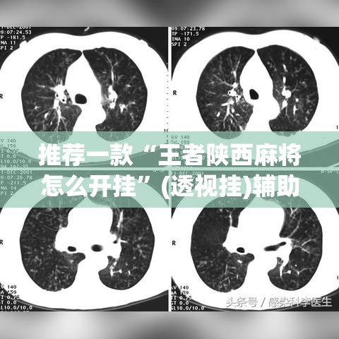 推荐一款“王者陕西麻将怎么开挂”(透视挂)辅助透视教程