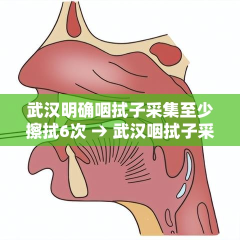 武汉明确咽拭子采集至少擦拭6次 → 武汉咽拭子采样机器人
