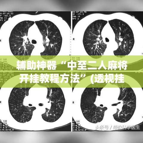 辅助神器“中至二人麻将开挂教程方法”(透视挂)辅助透视教程
