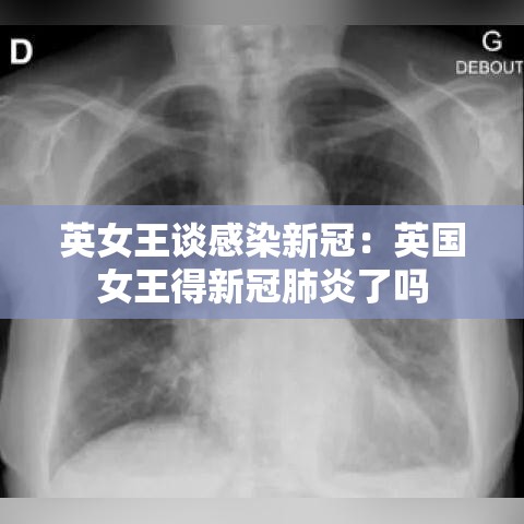 英女王谈感染新冠:英国女王得新冠肺炎了吗 英女王谈感染新冠:英国女王得新冠肺炎了吗