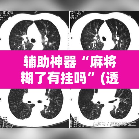 辅助神器“麻将糊了有挂吗	”(透视挂)辅助透视教程