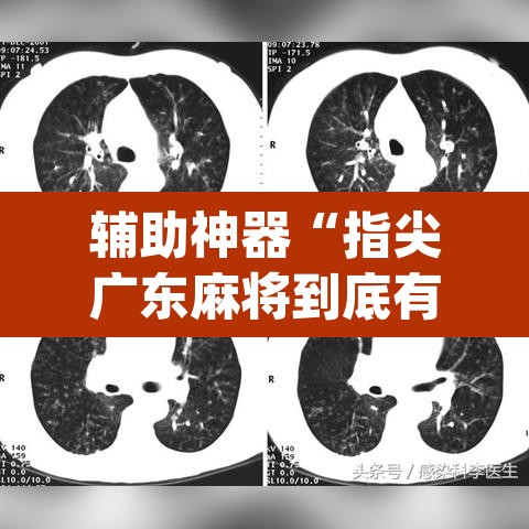 辅助神器“指尖广东麻将到底有没有挂	”(透视挂)辅助透视教程