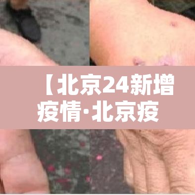 【北京24新增疫情·北京疫情 24日】 【北京24新增疫情·北京疫情 24日】