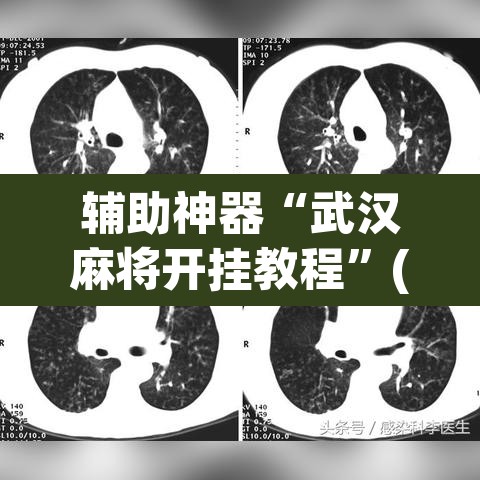 辅助神器“武汉麻将开挂教程”(透视挂)辅助透视教程