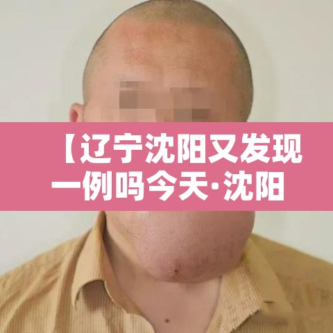 【辽宁沈阳又发现一例吗今天·沈阳发现一例疫情】