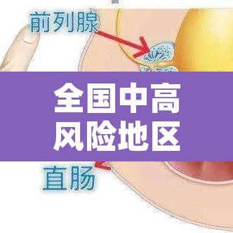 全国中高风险地区名单 → 全国中高风险地区名单一览表 全国中高风险地区名单 → 全国中高风险地区名单一览表