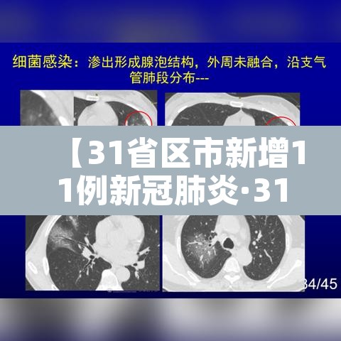 【31省区市新增11例新冠肺炎·31省区市新增病例8例】