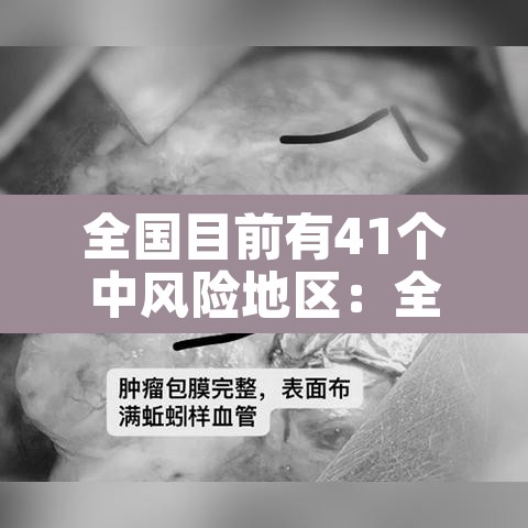 全国目前有41个中风险地区：全国目前有83个中风险地区